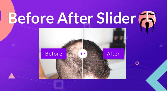 Divi Sensei Before After Slider homepage
